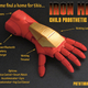 Image for article titled Iron Man Prosthetic Hand Will Make Kids Feel Like Superheroes